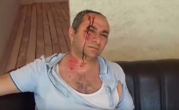 Abşeronda döyülən əlil öz evinə od vurdu – VİDEO – YENİLƏNİB