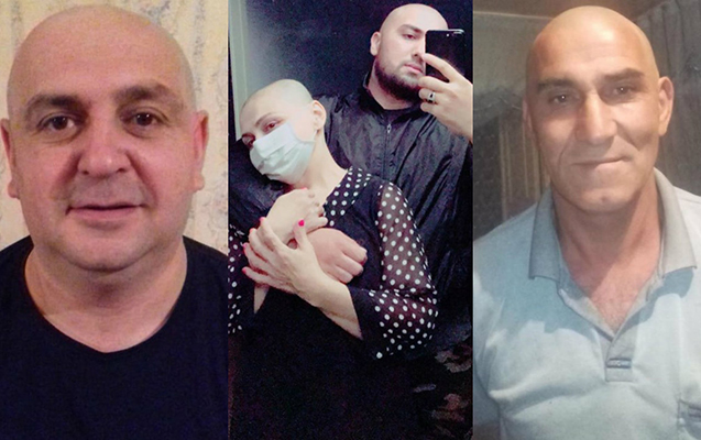 Onlar Tünzaləyə görə keçəl oldular – FOTO