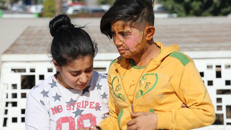 TÜRKİYƏDƏ DƏHŞƏT – Gənc qızı diri-diri yandırıb bu hala saldılar – FOTO