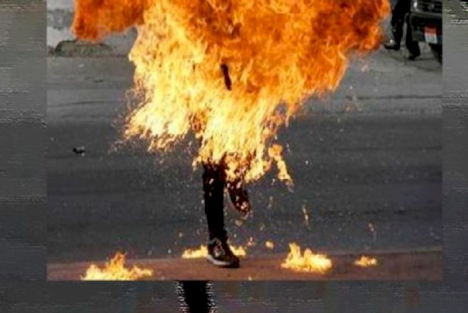 Azərbaycanda polis əməkdaşı özünə od vurdu – Foto
