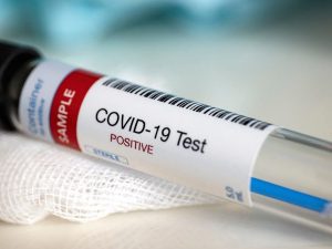 Azərbaycanda yüksək vəzifəli şəxsdə koronavirus aşkarlandı