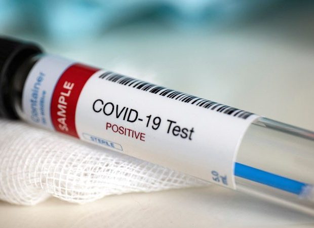 Azərbaycanda yüksək vəzifəli şəxsdə koronavirus aşkarlandı Azərbaycanda yüksək vəzifəli şəxsdə koronavirus aşkarlandı