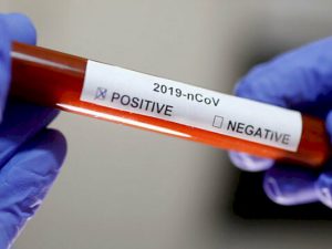 Beş yüksək vəzifəli şəxsdə koronavirus tapıldı…