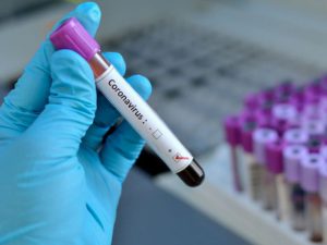 Koronavirus bu tarixdə pik həddə çatacaq – AÇIQLANDI