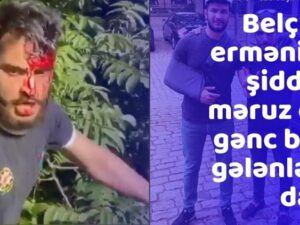 Belçikada ermənilərin şiddətinə məruz qalan gənc başına gələnlərdən danışıb- VİDEO