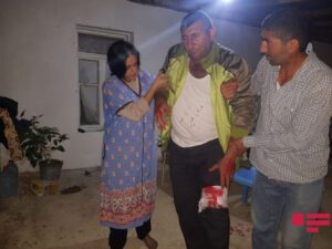 Ermənilərin yaraladığı mülki vətəndaşımızın – Fotosu