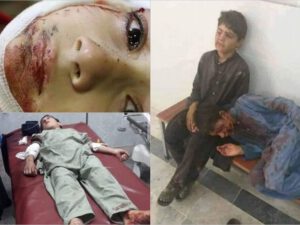 Pakistanda İslam məktəbində partlayış: Çox sayda ölənlər və yaralananlar var – FOTO