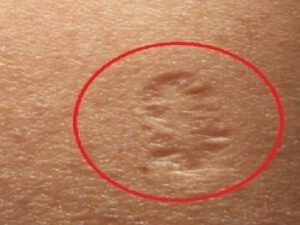 Sol qolunuzun yuxarı hissəsindəki çapığın sirrini bilirsinizmi? Bu hamıda olan çapığın ağlınıza belə gəlməyən sirri!