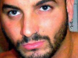 Yadplanetliyə oxşamaq üçün burnunu və dodaqlarını kəsdirdi, indi danışa bilmir – FOTO