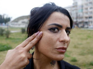 Sevgilisi ilə dalaşan kosmetoloq fikirli olub müştərisinin üzünü bu hala saldı – FOTO