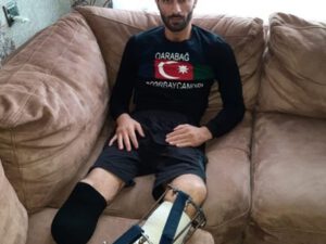 “Hər iki ayağımı itirmişəm, mənə 3-cü qrup əlillik verilib” – Foto