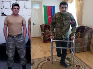 Yaralı dostunu xilas edəndə minaya düşən qazi: “Komandirim elə bildi ki, şəhid olmuşam” – MÜSAHİBƏ + FOTO