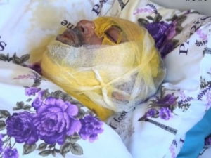 Bərdədə qız sevgilisini niyə yandırdı? – TƏFƏRRÜATLAR