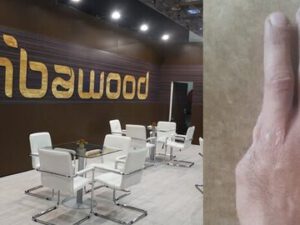 “Embawood” da QALMAQAL: İşçinin barmağı QOPDU, şirkət isə… – FOTOLAR
