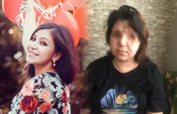Gəncə terrorunda 2 gözünü itirən Pərvin… – FOTO Gəncə terrorunda 2 gözünü itirən Pərvin… – FOTO