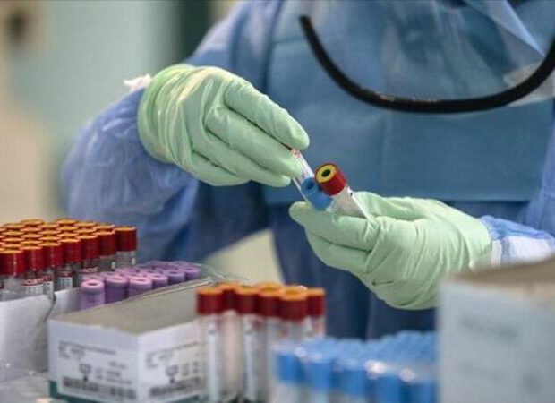 Ötən sutka Azərbaycanda koronavirusdan ölüm halı qeydə alınmayıb