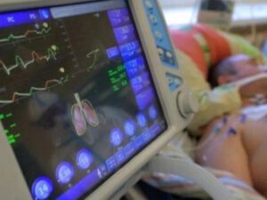 Həbsdə koronavirusa yoluxan sabiq icra başçısı ECMO-ya qoşuldu
