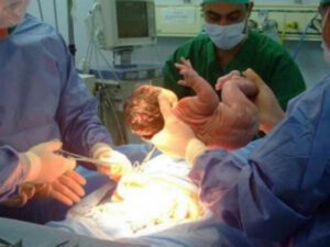 Azərbaycanda FACİƏ: ana doğuş zamanı öldü, körpəsi isə…