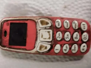 Əməliyyat olunan şəxsin mədəsindən “Nokia” çıxdı – FOTO