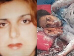 Qayınatası tərəfindən üzünə “kislota” töküldüyü deyilən qadın öldü